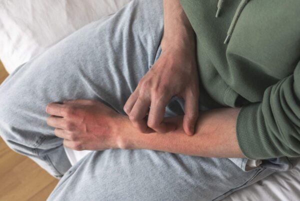Is Skin-Picking a Form of Self-Harm